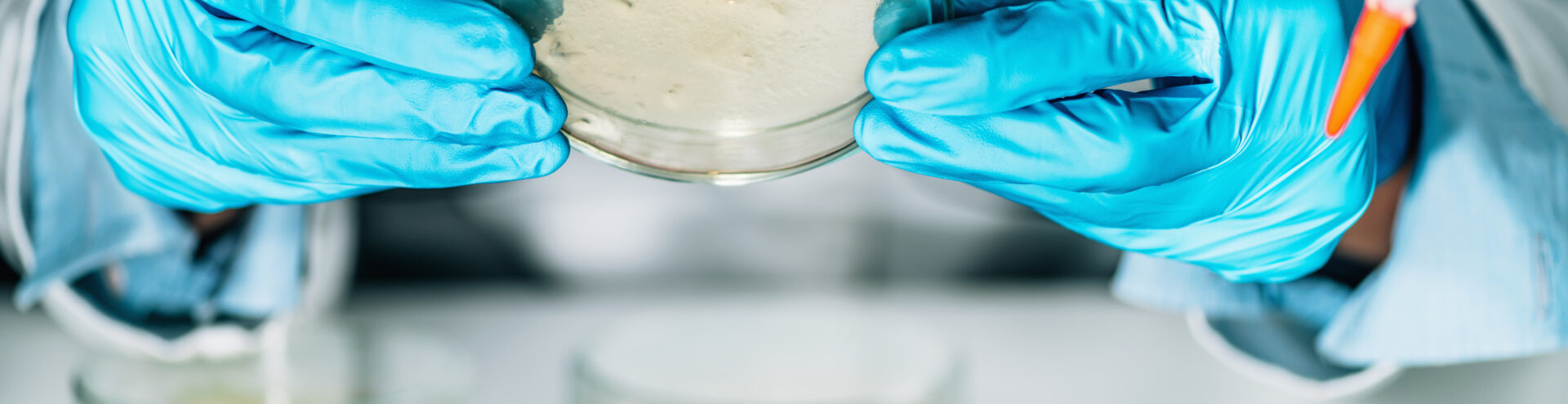 Microbiologist examining a petri dish with agar